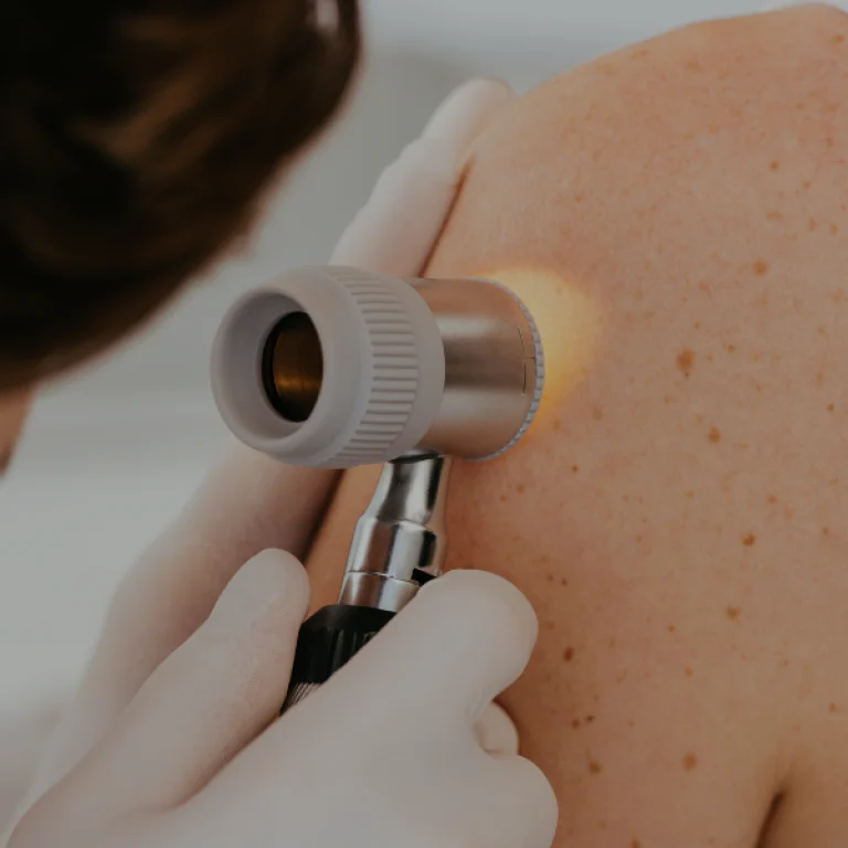 Larger lesions_ with flap reconstruction, individual assessment