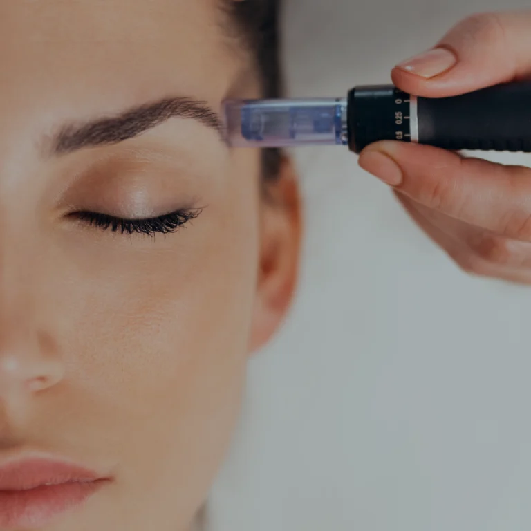 Mesopen face 3 times