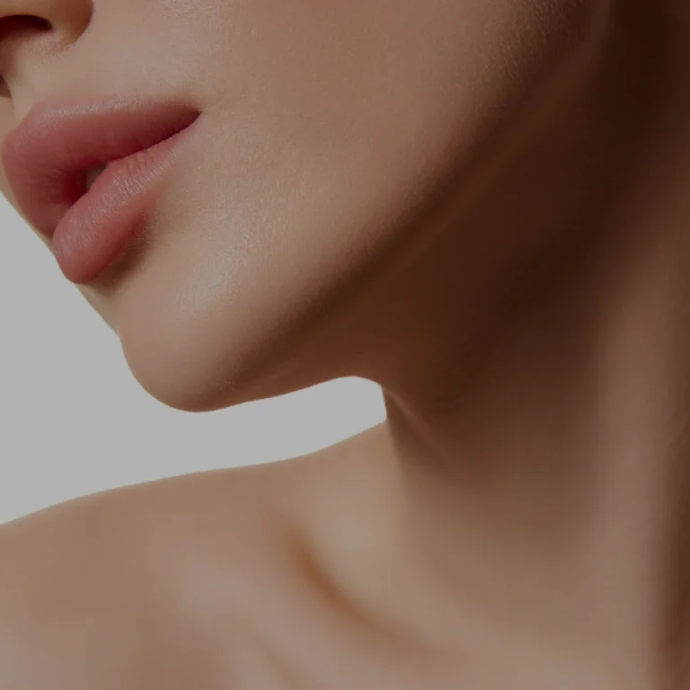Nefertiti botox (neck contour)